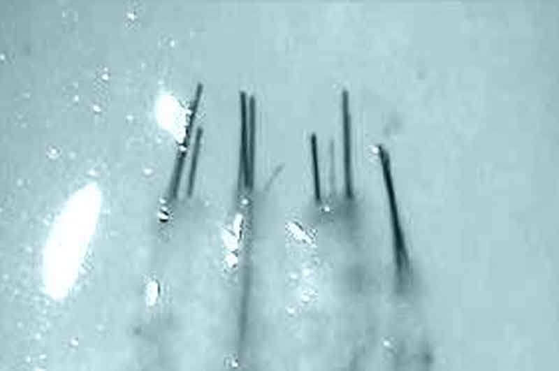 3 hair grafts