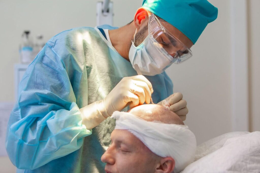  A male surgeon in scrubs, mask, and protective glasses performs a hair transplant on a male patient, carefully working on the scalp with small instruments.