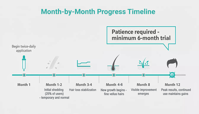 Timeline infographic showing typical minoxidil treatment progression from month 1 through month 12
