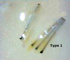 A magnified view shows several individual hair follicles grafts, each with a strand of hair, immersed in a clear liquid.