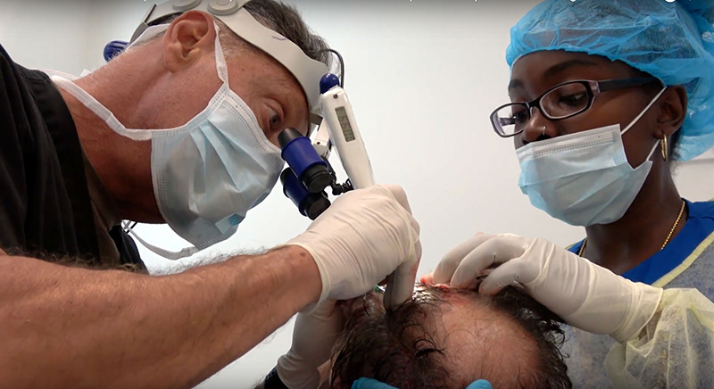 Hair transplant surgery session