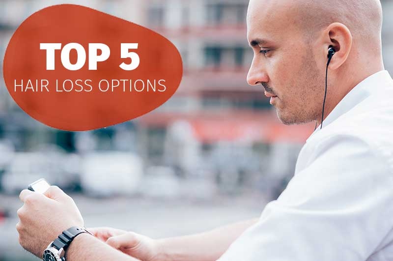 Top 5 hair loss options