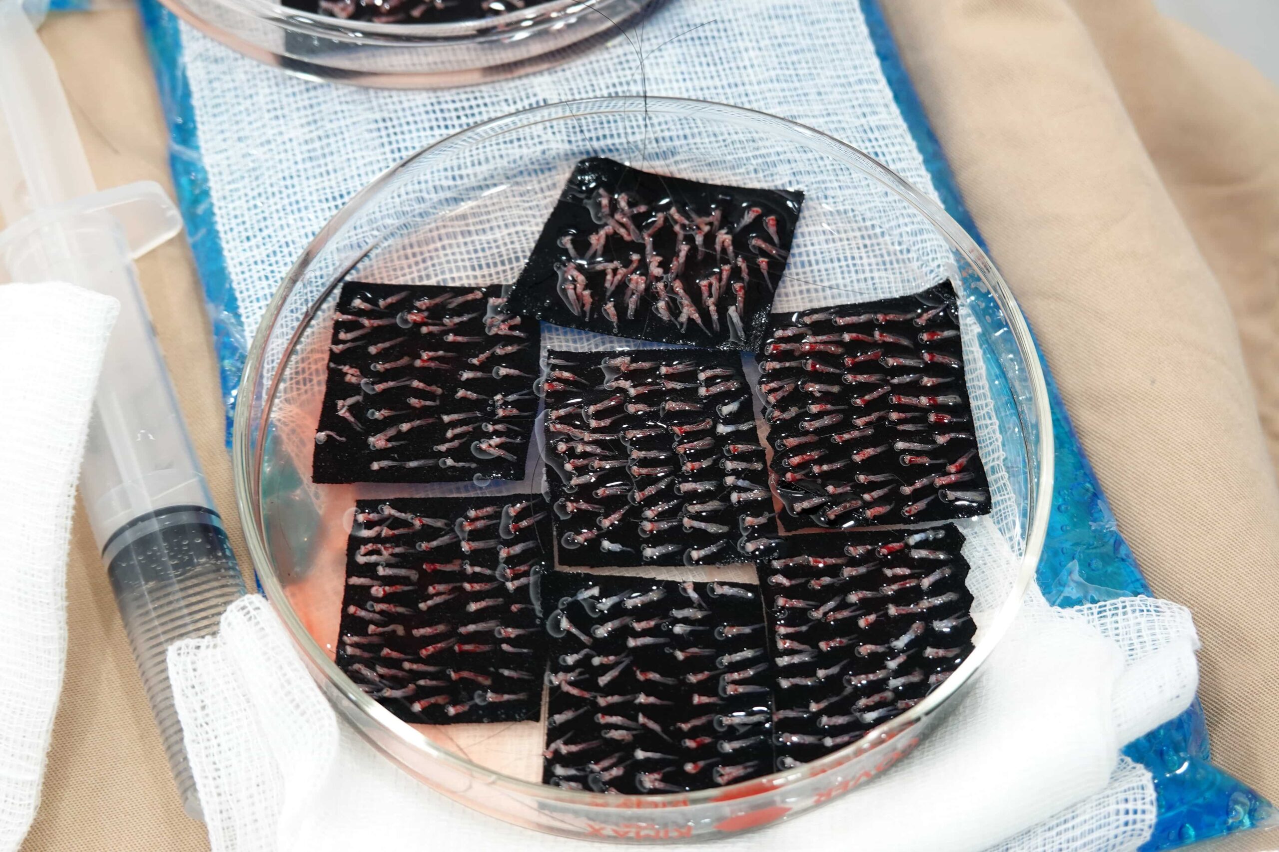 A top-down, close-up shot of a glass Petri dish containing dozens of harvested hair follicles prepared for a hair transplant.
