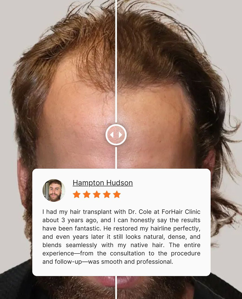 ForHair' Patient testimonial on Google