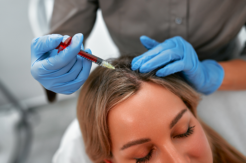 Woman PRP injections for hair loss