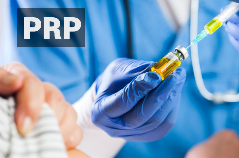 PRP Treatment