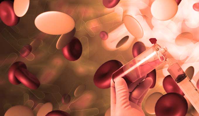 PRP treatment