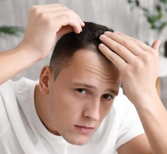 Affected areas of hair loss
