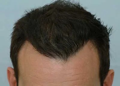 www.forhair.com/