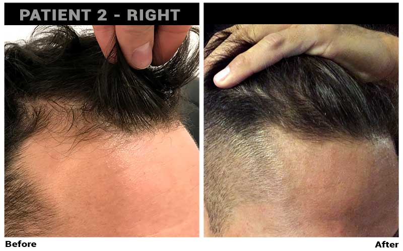 Dr. Cole Live: Anti-aging, Treatment Progress, and FUE Europe, Forhair