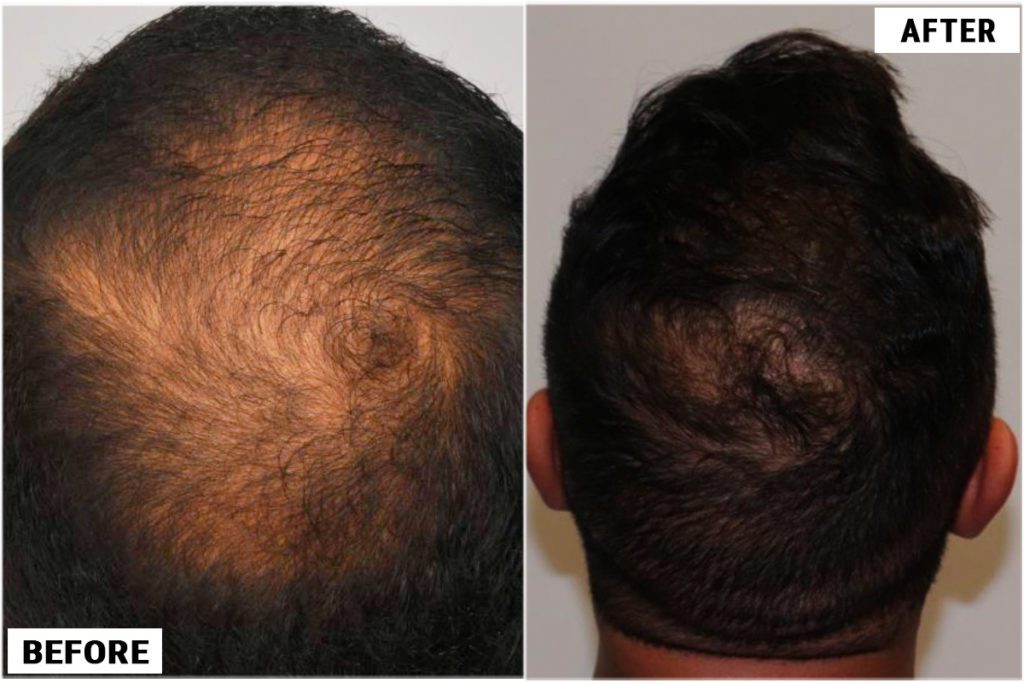 Noticeable improvements to hair follicles