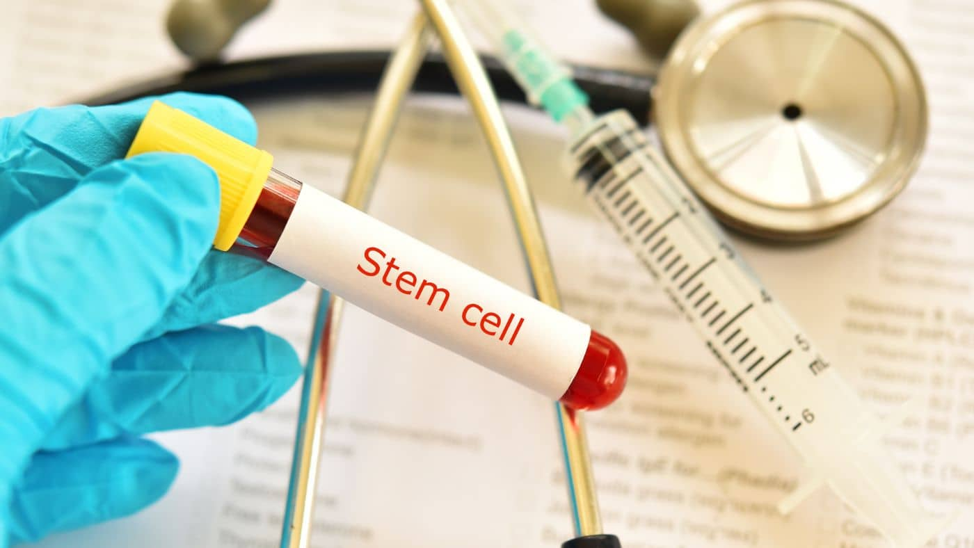 A close-up showing stem cells for hair treatment