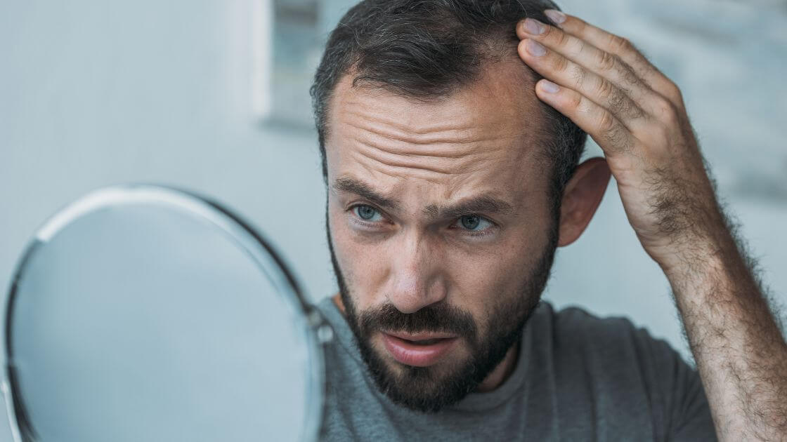 A man with thinning hair looking in the mirror