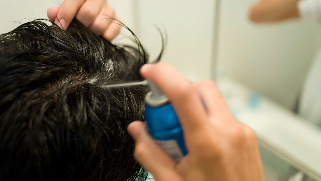 An image showing a man undergoing hair restoration for men using an alternative method