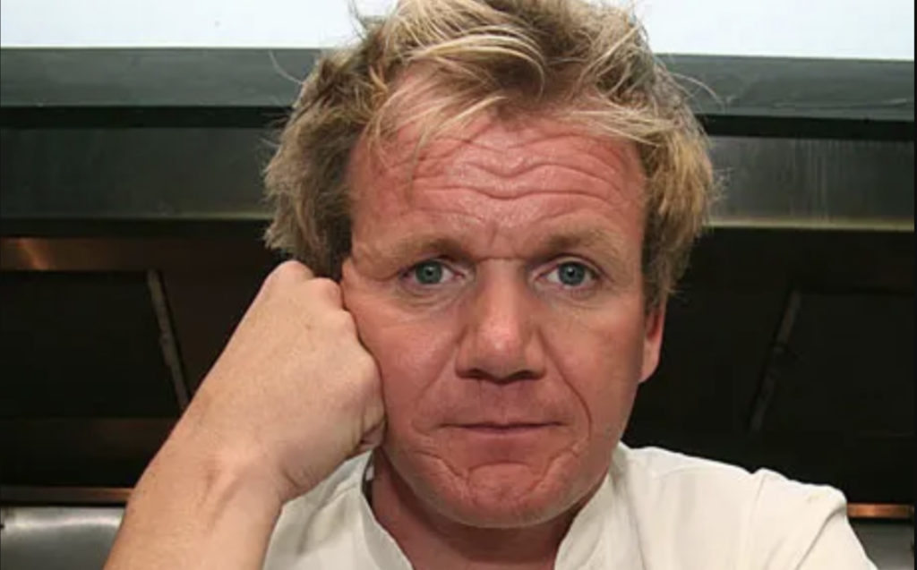 Gordon Ramsay - Hair Transplant Journey