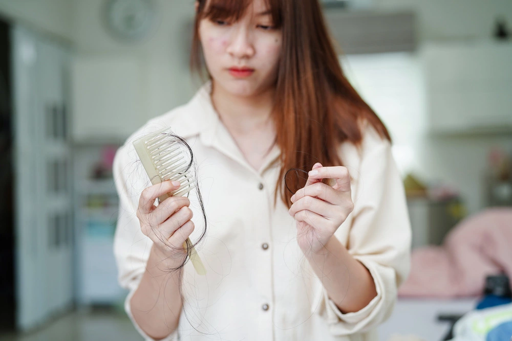 Asian woman has problems with hair loss due to stress