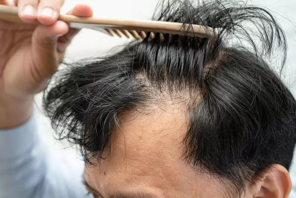 man checking hair for hair loss