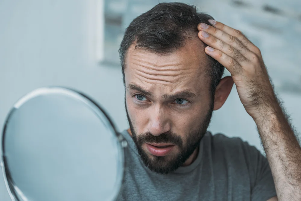 hair loss after surgery