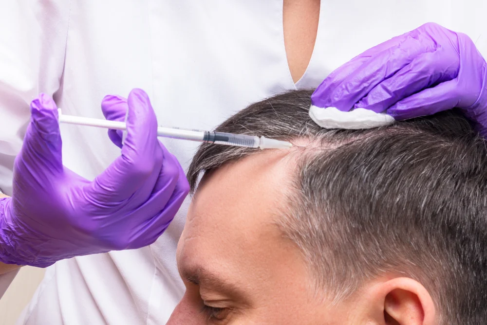 non surgical hair restoration options