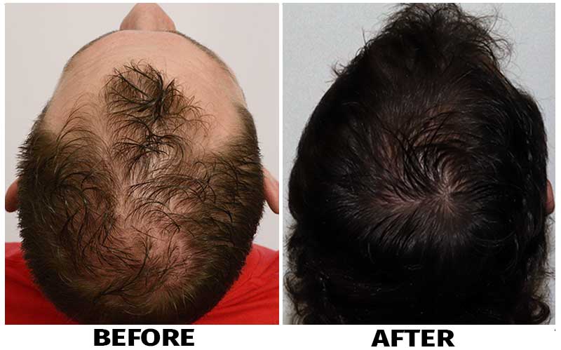 Before and after back view