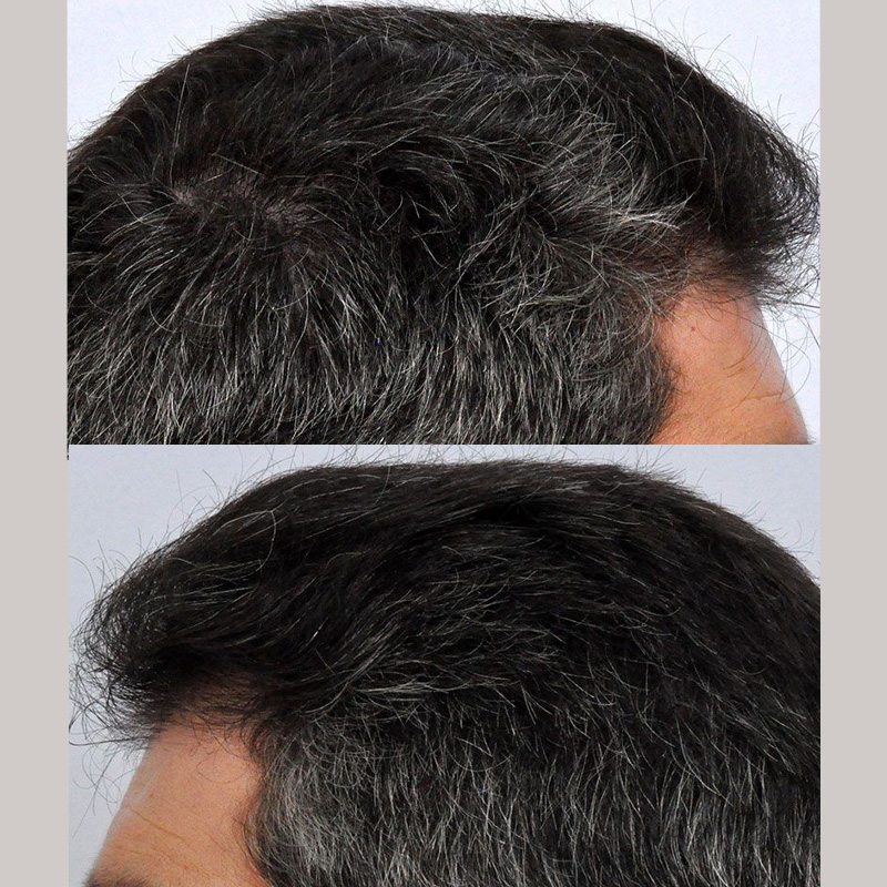 After side views