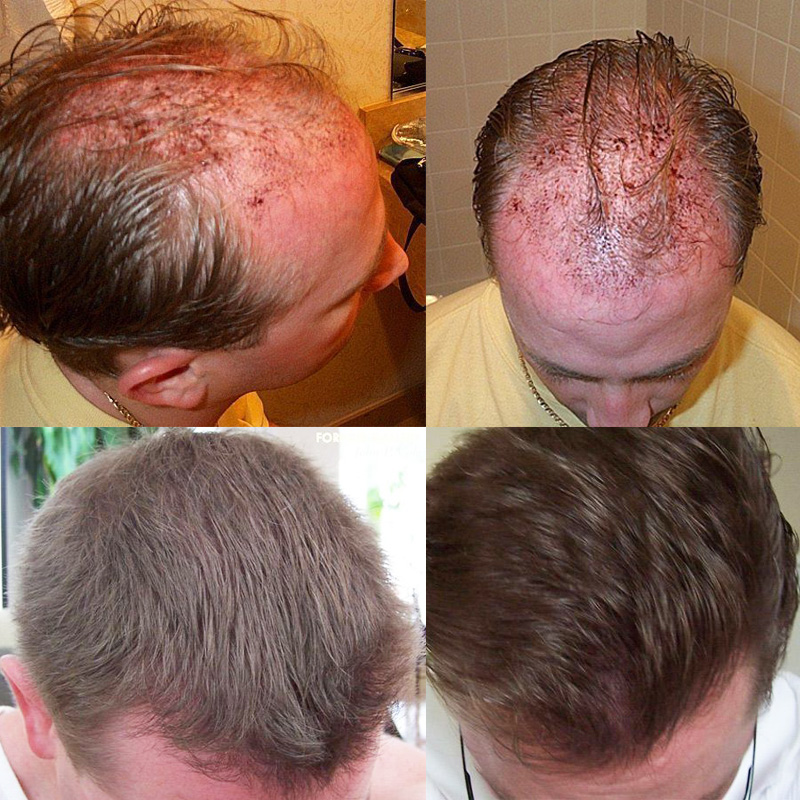 Before and after side view