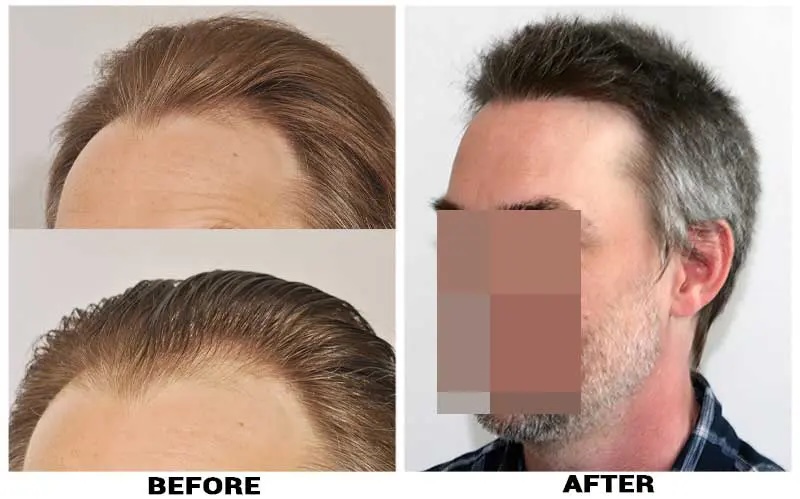 Before after collage left