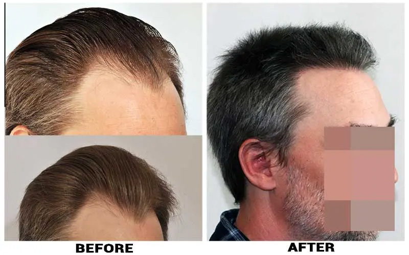 Before after collage right