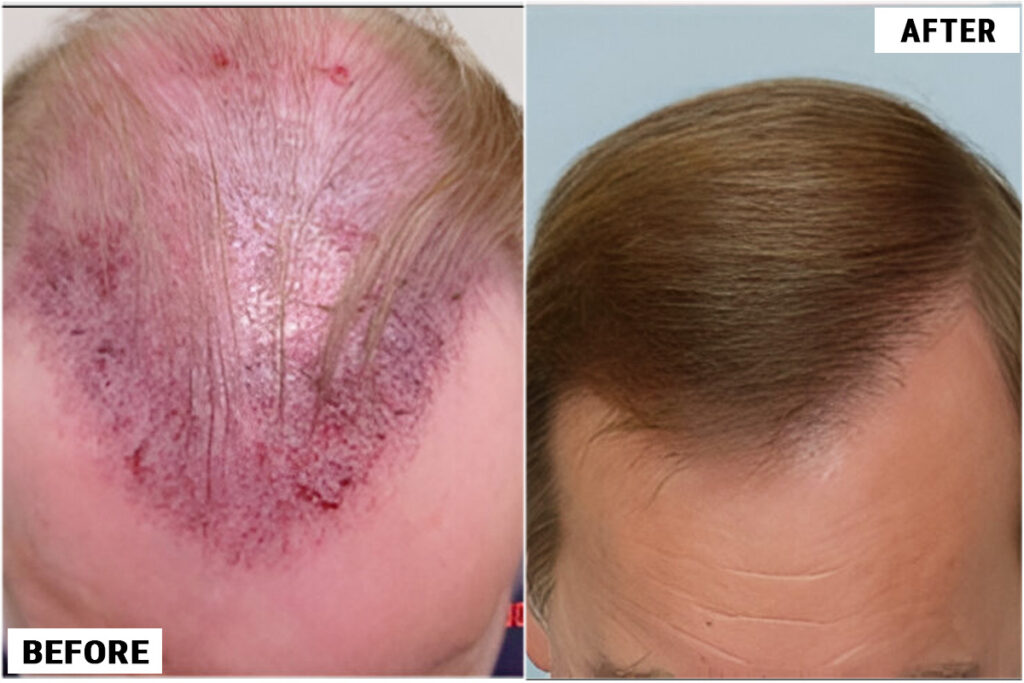 Immediate after surgery and after top 