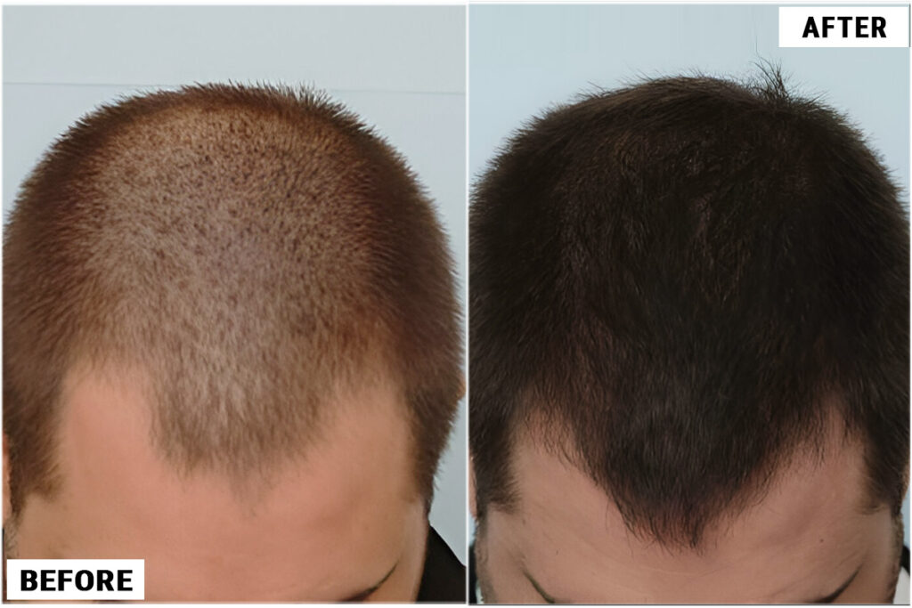 Before and after top