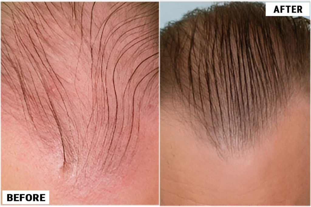 Before and after top close-up