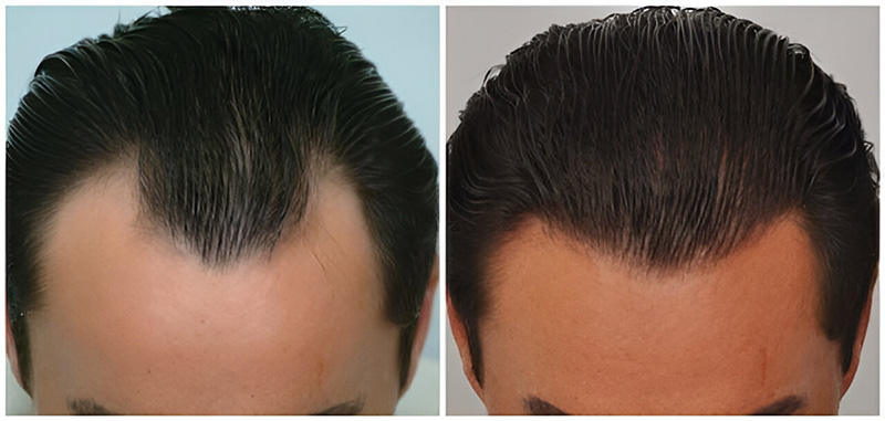 Before and after top wet hair
