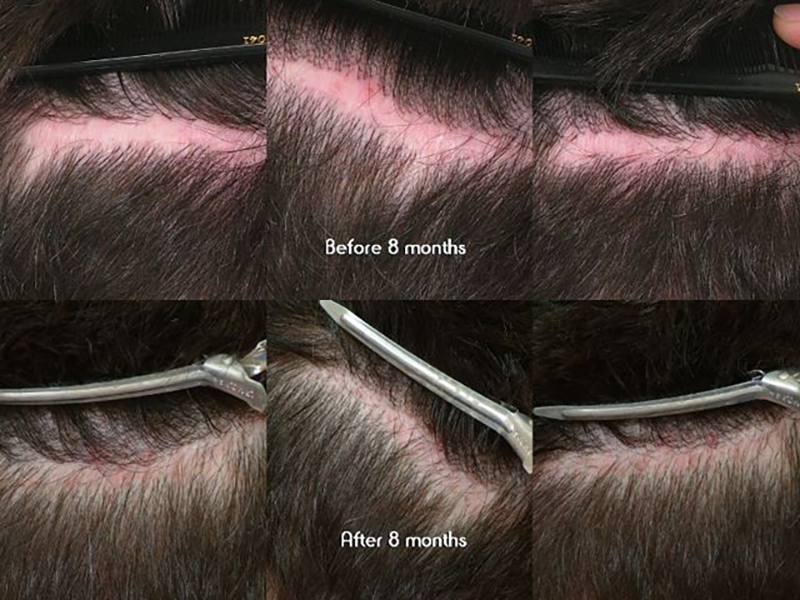 Before and after 8 months