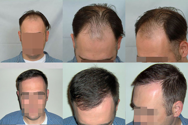Before and after collage