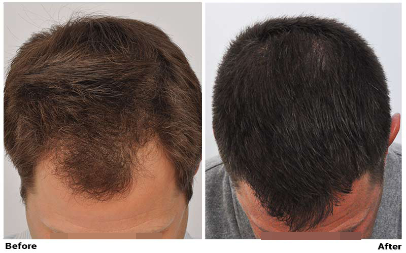 Top view dry hair