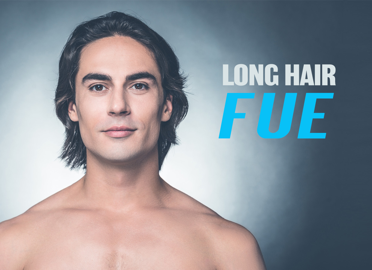 Long hair FUE hair transplantation