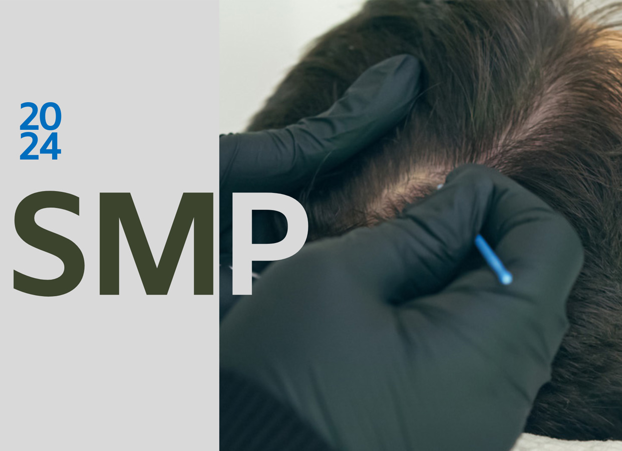 SMP treatment for hair loss