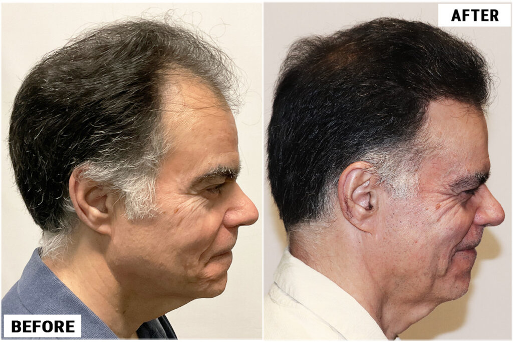 before and after right 2