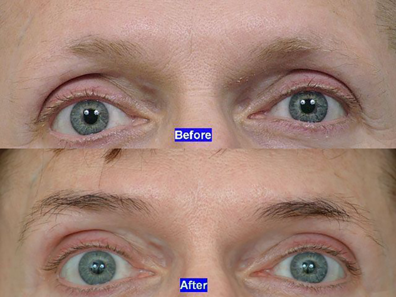 Before & After Comparison 1