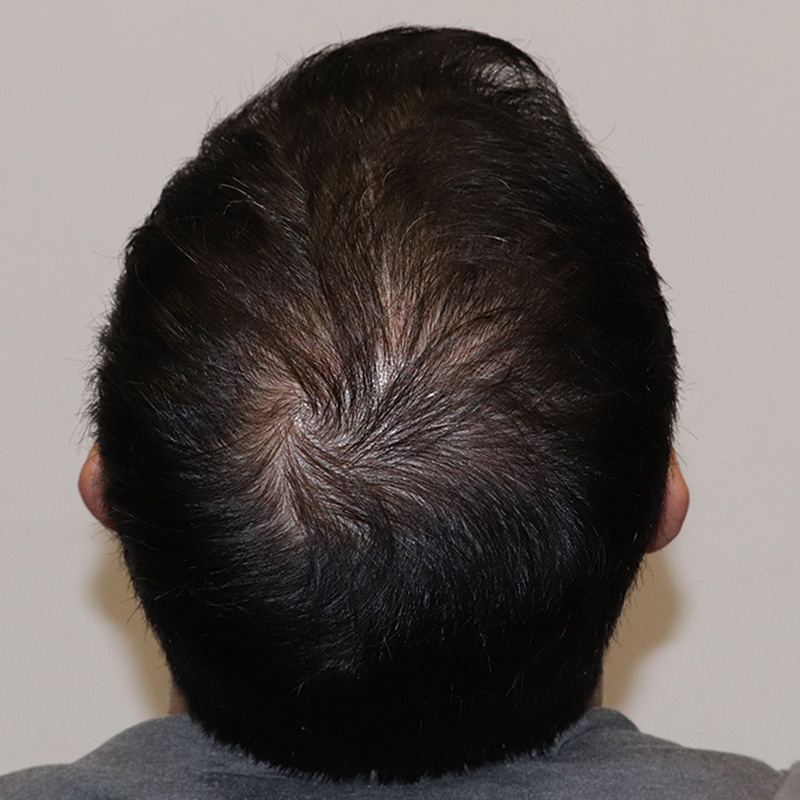 CRP #5 before and after crown 2