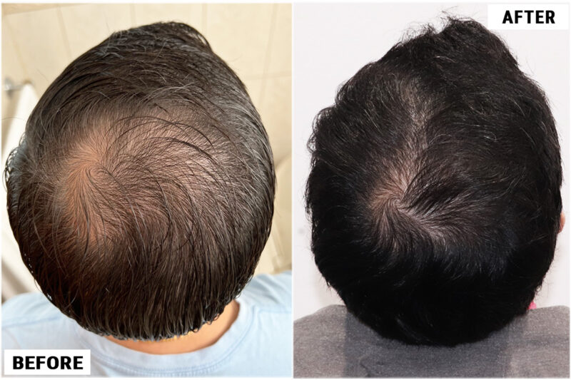 CRP #5 before and after crown 2