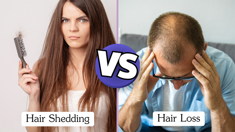 Hair loss vs. hair shedding