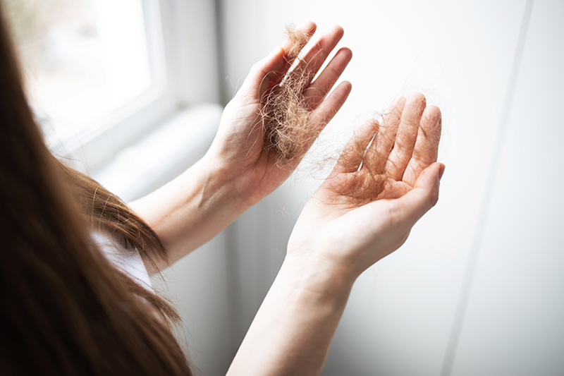 Shedding of hair