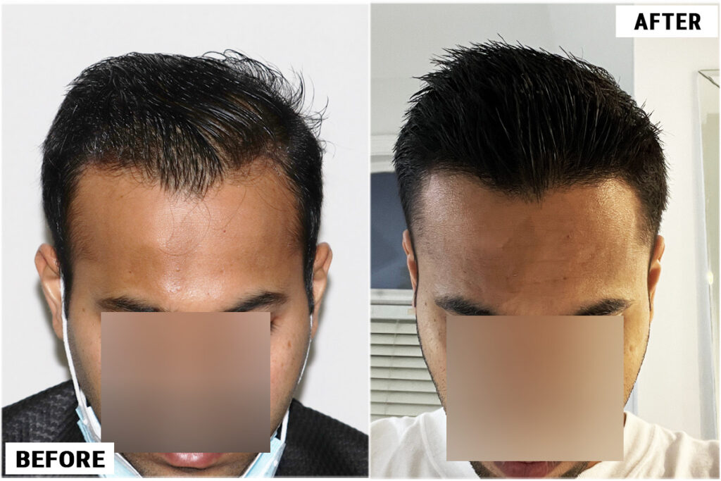 FUE 1963 results - comparison