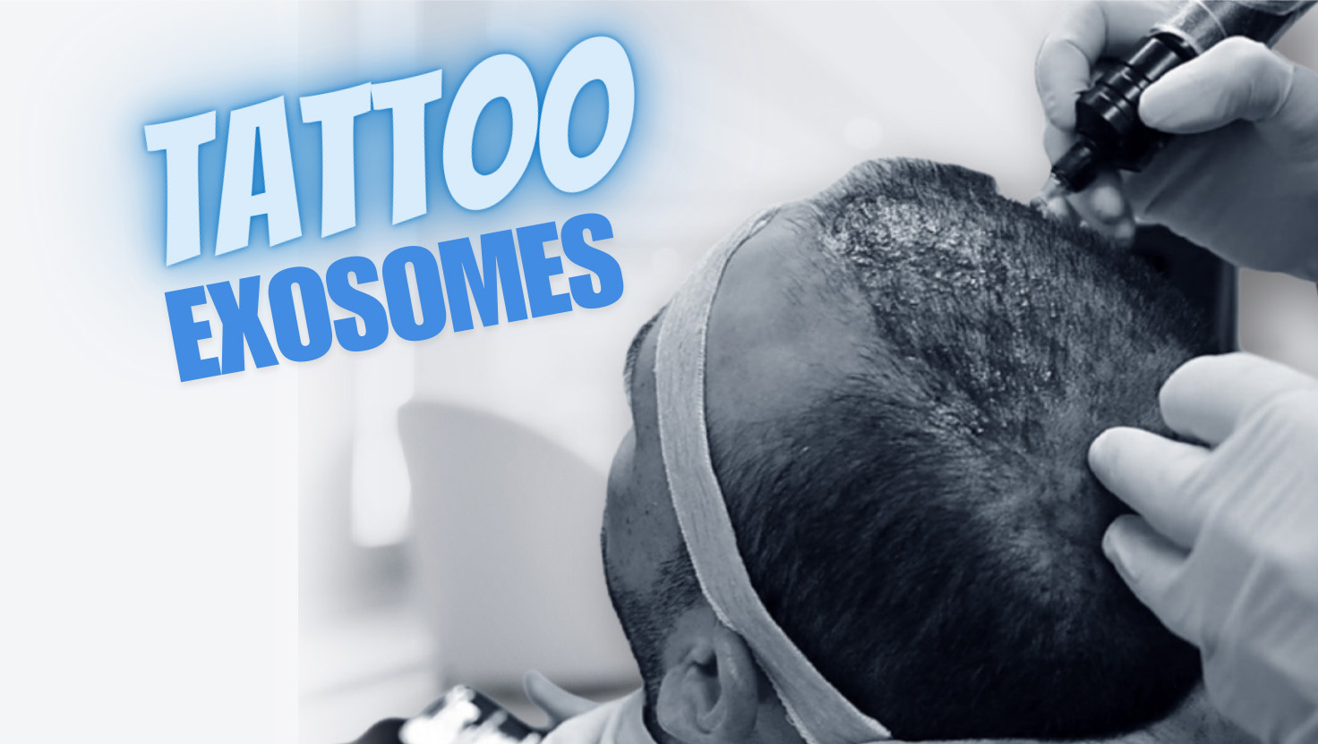Tattoo Exosomes treatment