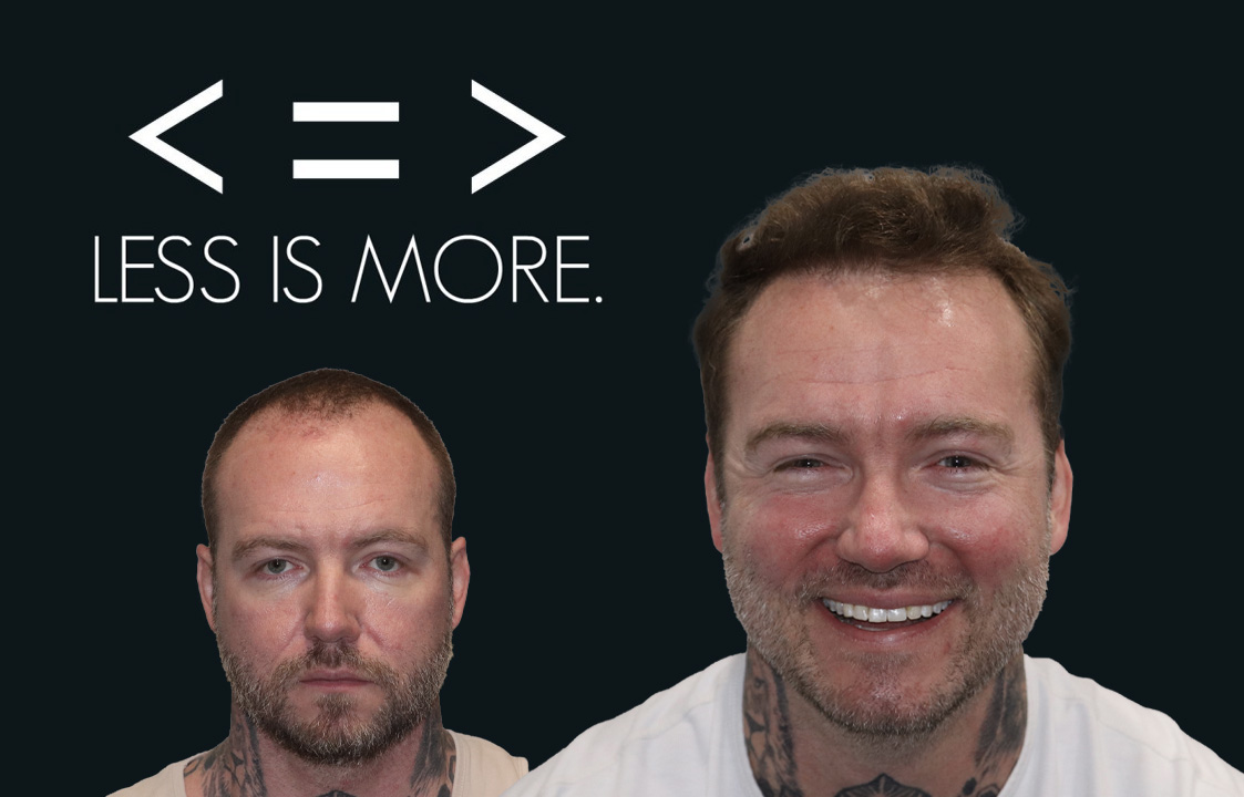 Less is more patient results