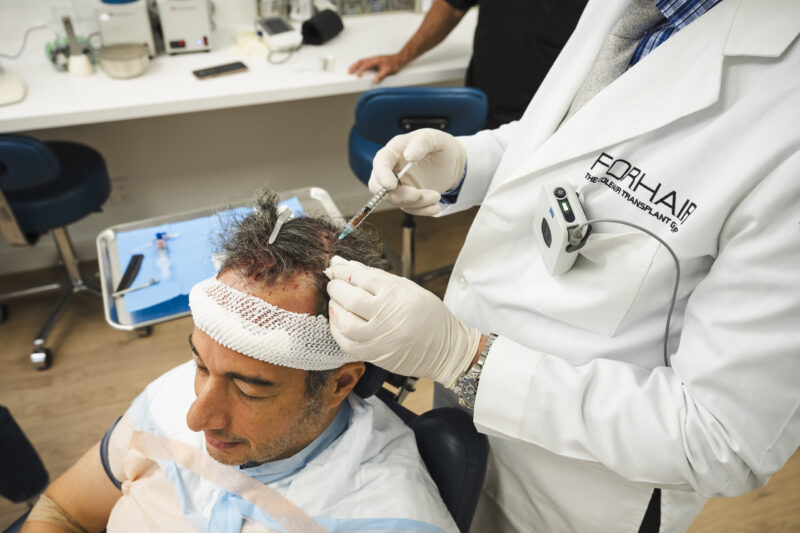 Forhair’s team performing a post hair transplant regenerative procedure on patient’s skalp